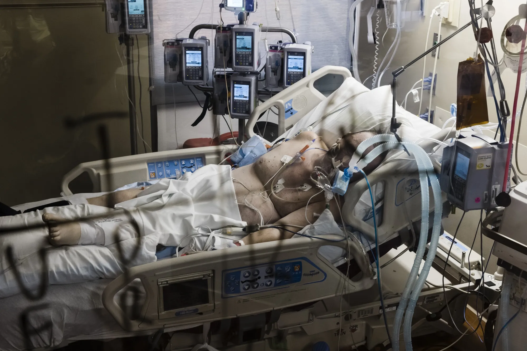 The painful route to immunity.
