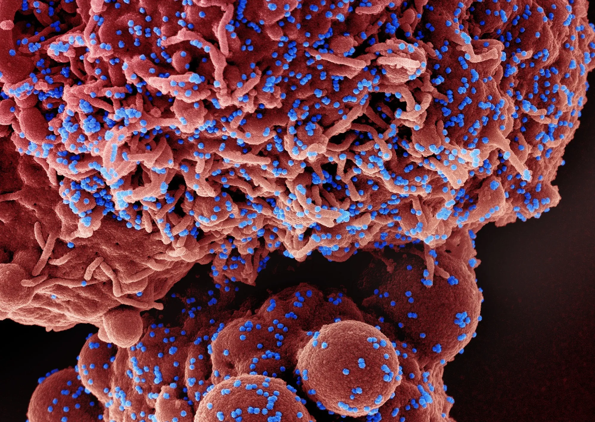 The Omicron strain of SARS-CoV-2 virus particles.