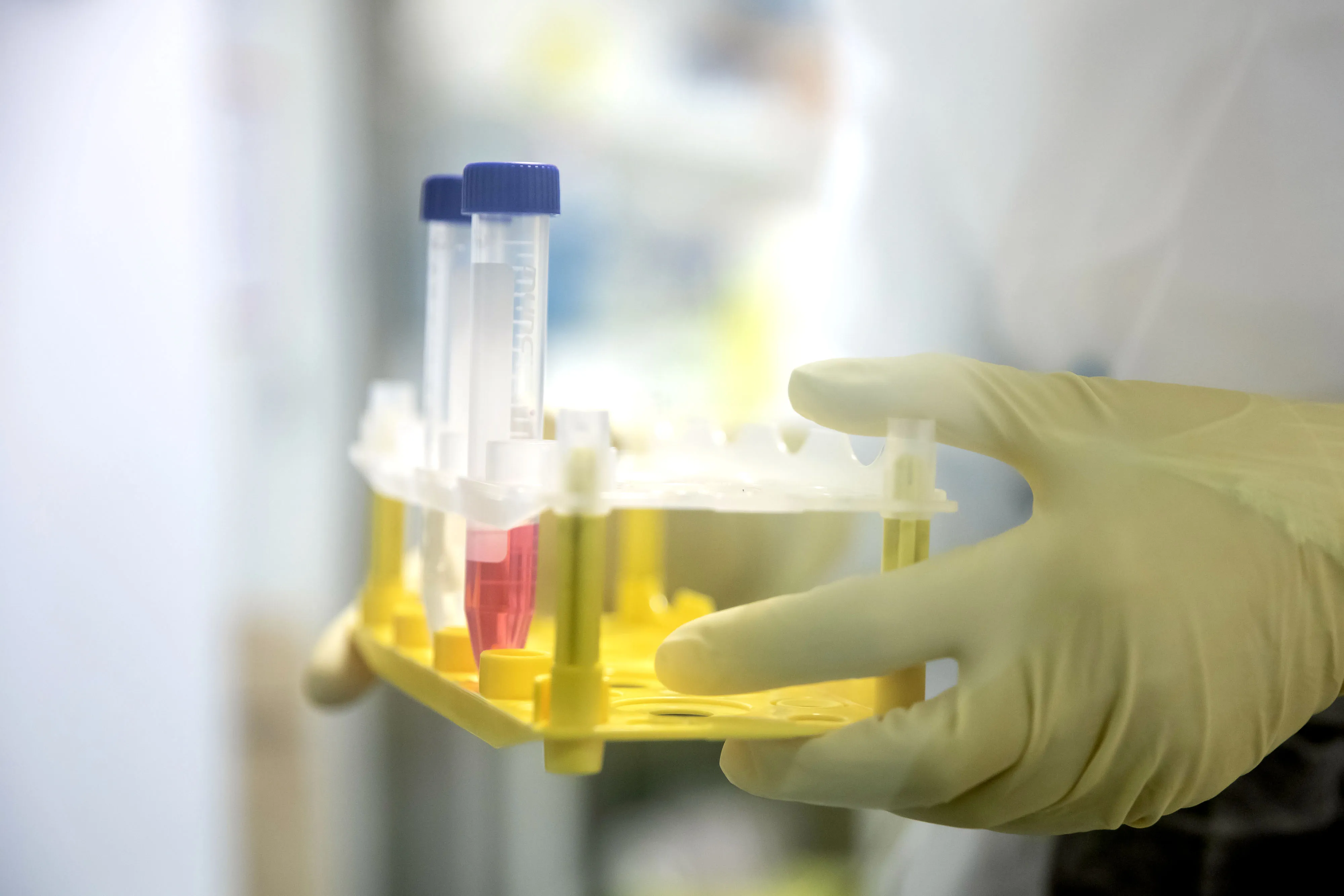 A&nbsp;researcher holds a test tube rack containing cells to be infected with Covid-19 during coronavirus vaccine research work in Lille, France.