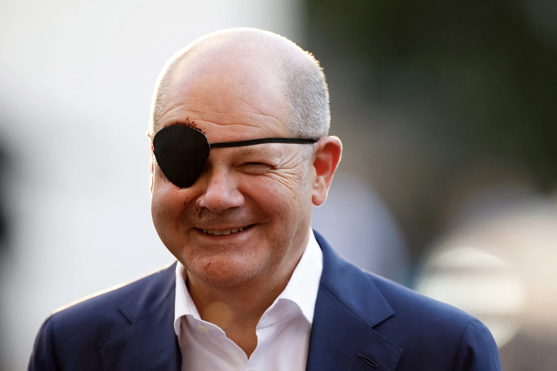 Chancellor&nbsp;Olaf Scholz wearing an eye patch while attending&nbsp;the annual St. Michael reception of the Catholic Church in Berlin, on Sept. 4.