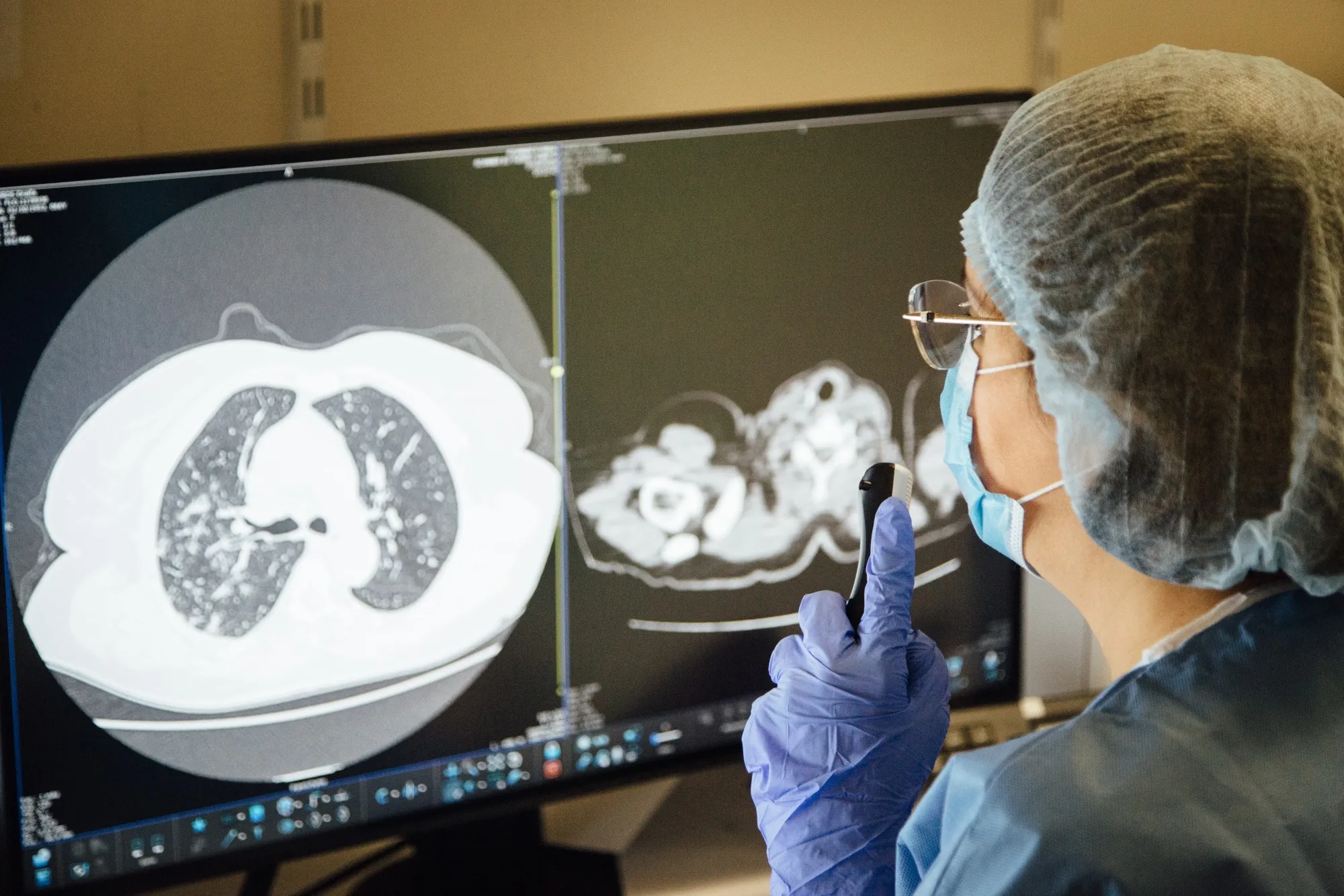 Costly CT Scans Filling Coronavirus Testing Void for U.S. Doctors(01)