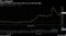 Moderna shares have been driven to an all-time high