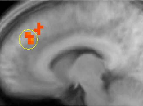 An fMRI image from the Caltech study shows the main activation in the paracingulate cortex, an area associated with theory of mind.