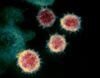 Coronavirus covid-19