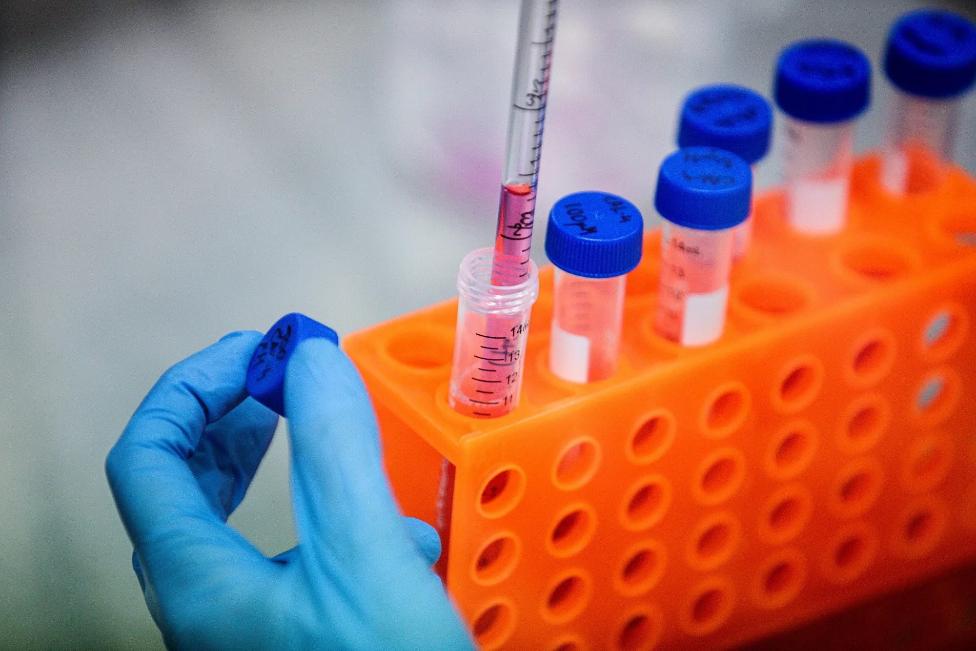 Hungarian Coronavirus Testing At University of Pecs Szentágothai Research Center 