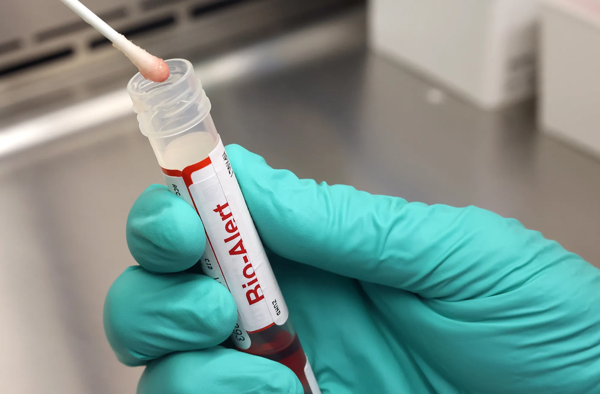 A swab that tested positive for Monkeypox at the UW Medicine Virology Laboratory in Seattle, Washington on July 12.&nbsp;