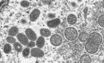 An electron microscopic&nbsp;image depicted a monkeypox virion.