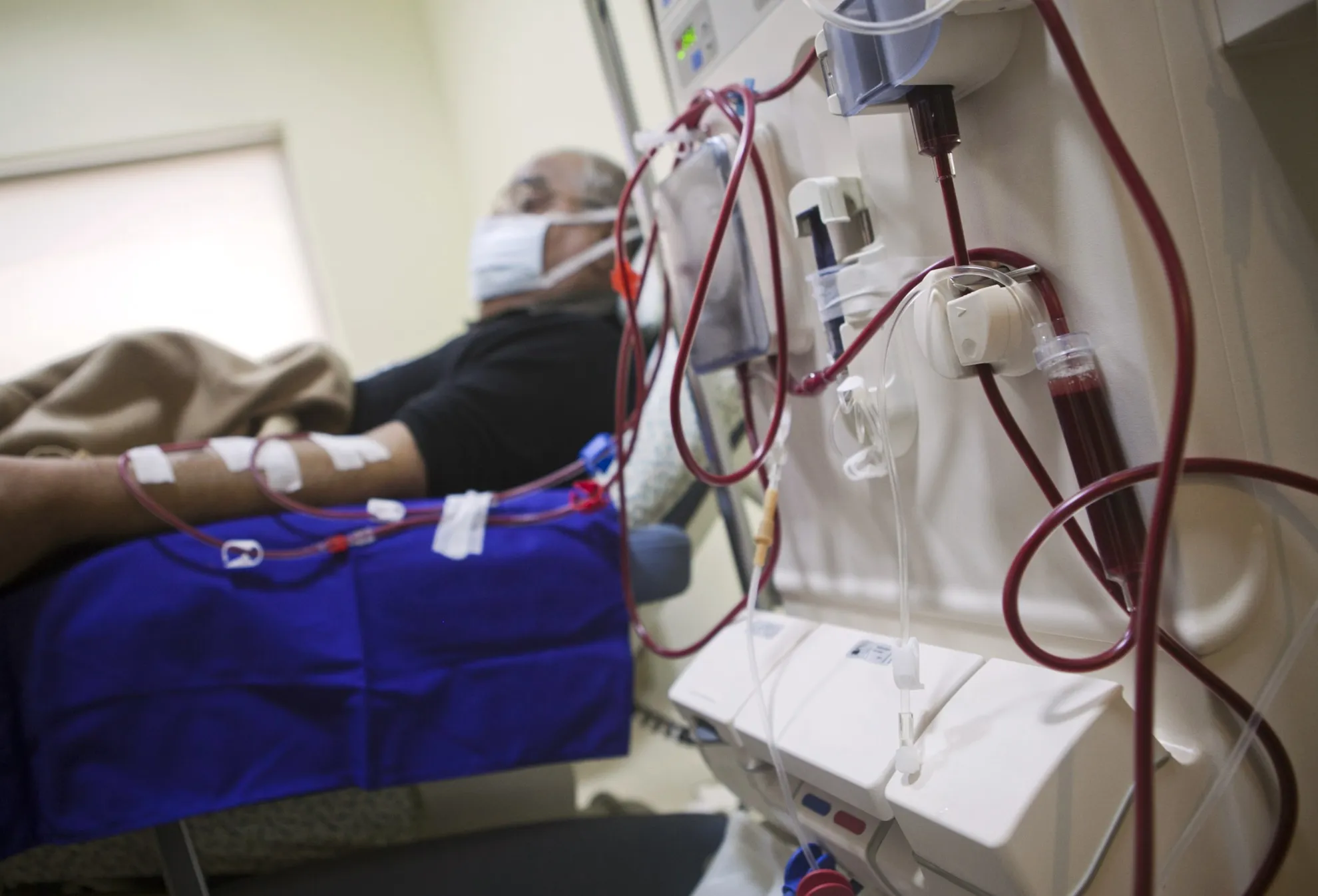 A patient undergoes dialysis, aided by a Fresenius Medical Care AG machine.