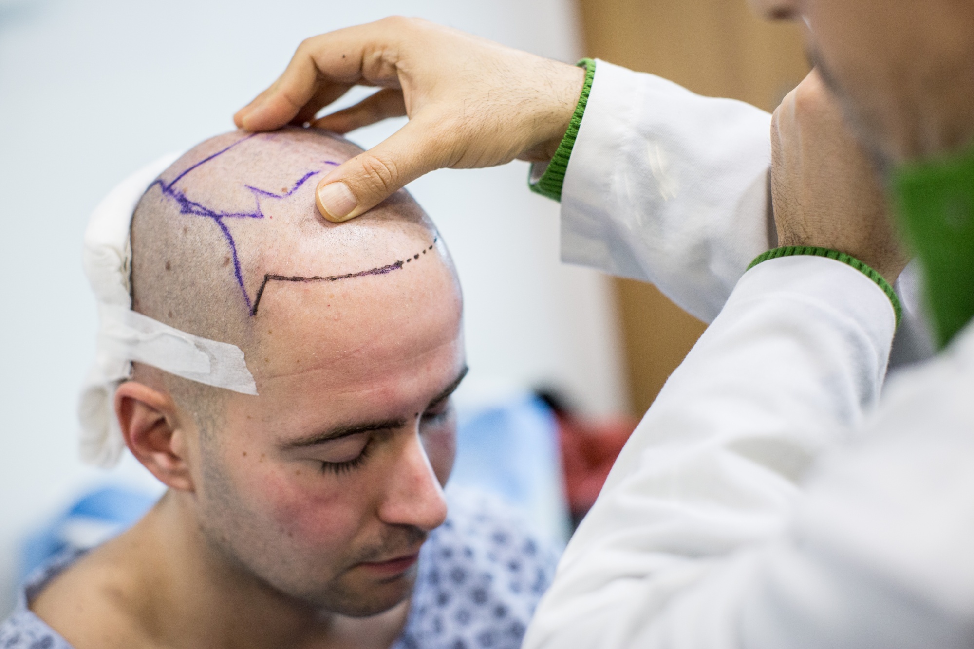 Turkey has made a name by selling quick pay-up-front treatments that include hair transplants. Photographer: Chris McGrath/Getty Images Europe