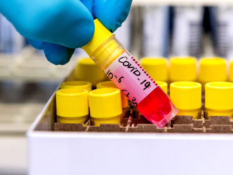 Virus Study Finds Most Risk Among Family, Less for Others