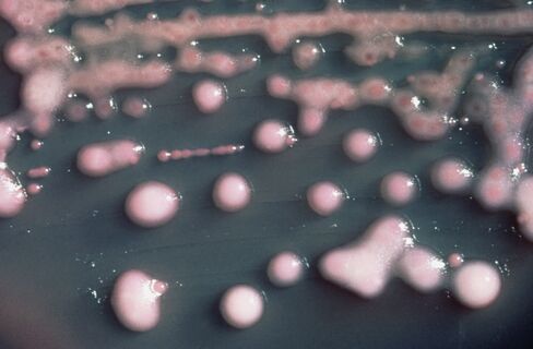 Superbugs Spread to 40 Nations Threatening India Medical Tourism