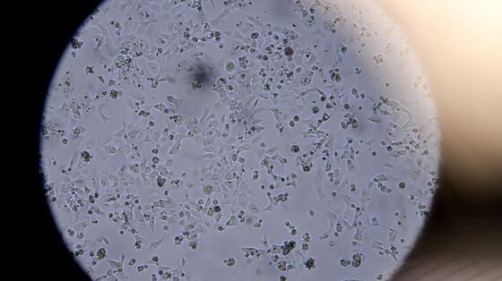 WHO Rejects Virus Lab Theory, Saying Animals Likely Source