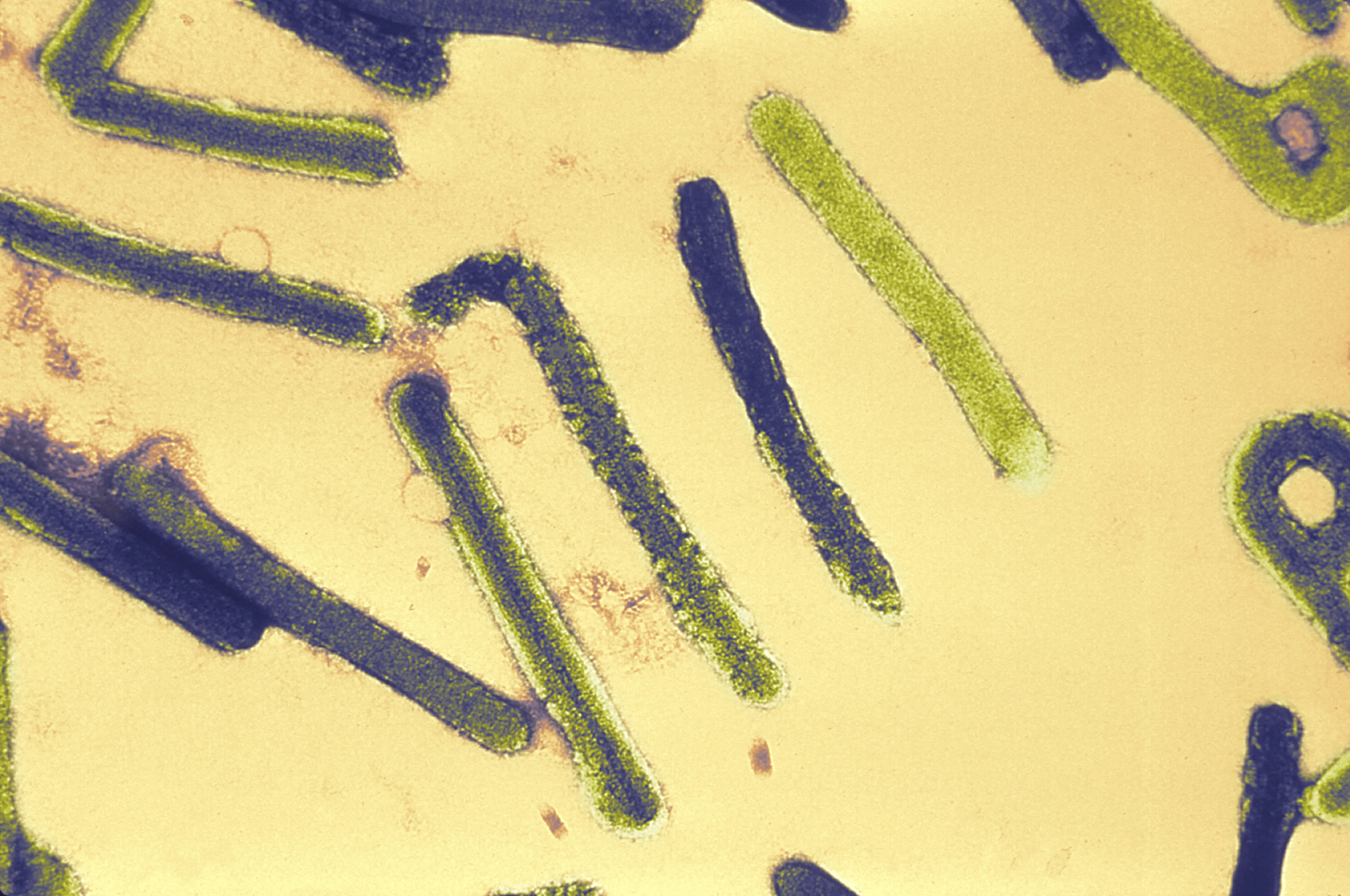 This electron micrograph depicts a number of Marburg virions.