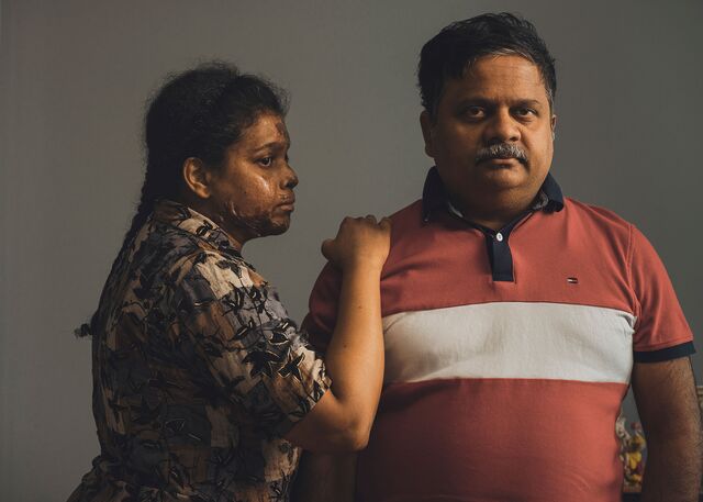 Susmita Maddi and Venkateswara Pasumarti photographed in their home in Virginia, on July 31. Maddi was severely burned when she was trapped inside the Tesla her husband crashed.