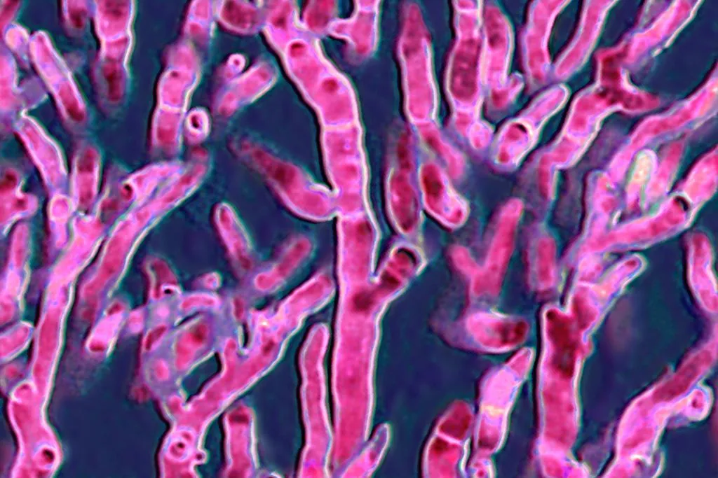 Aspergillus fumigatus, the fungus responsible for severe infections such as aspergilloma.