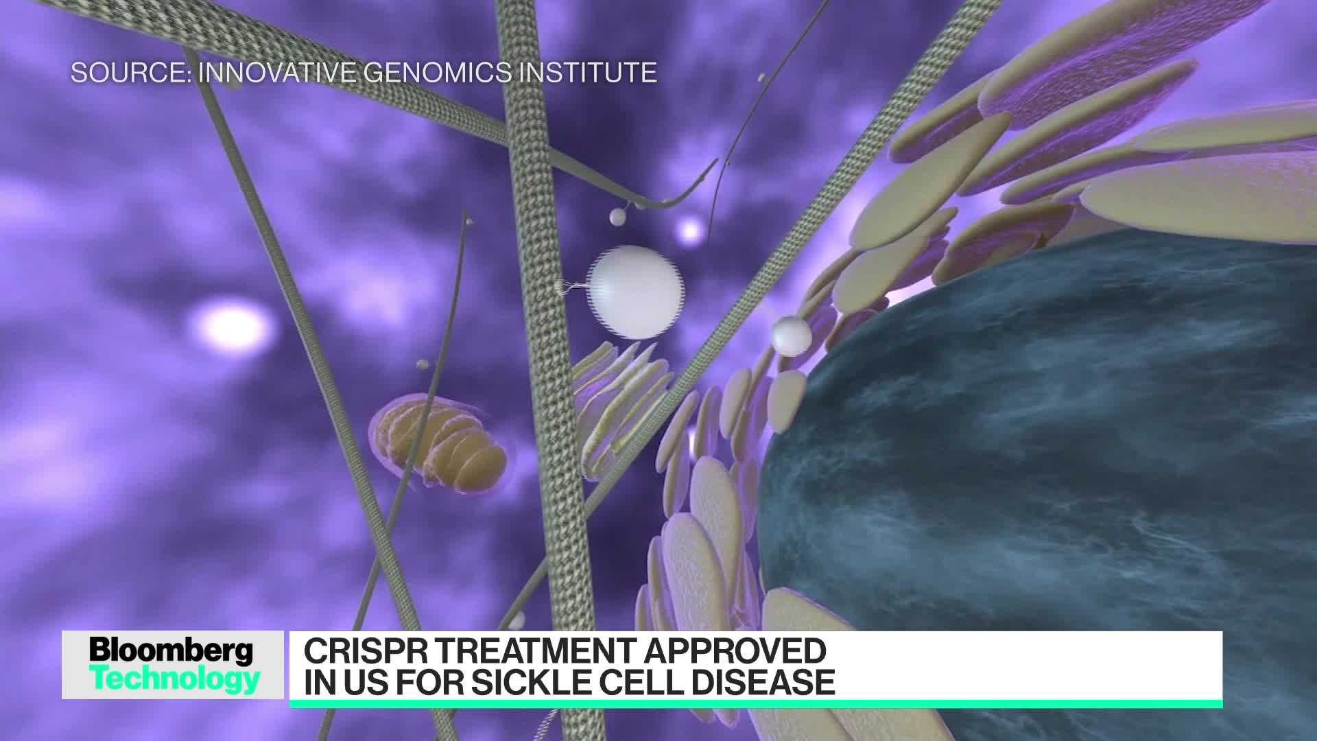 Watch FDA Approves First Crispr Treatment For Sickle Cell Disease ...