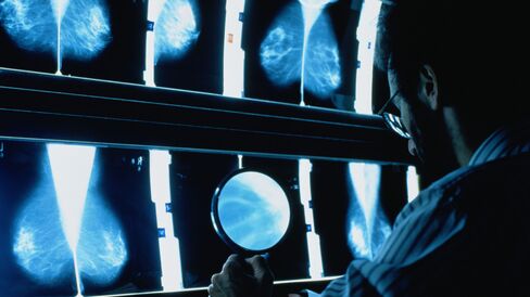 If women at the highest risk for aggressive breast cancer can be identified, they would be most likely to benefit and less likely to be harmed by earlier and more aggressive screening.
