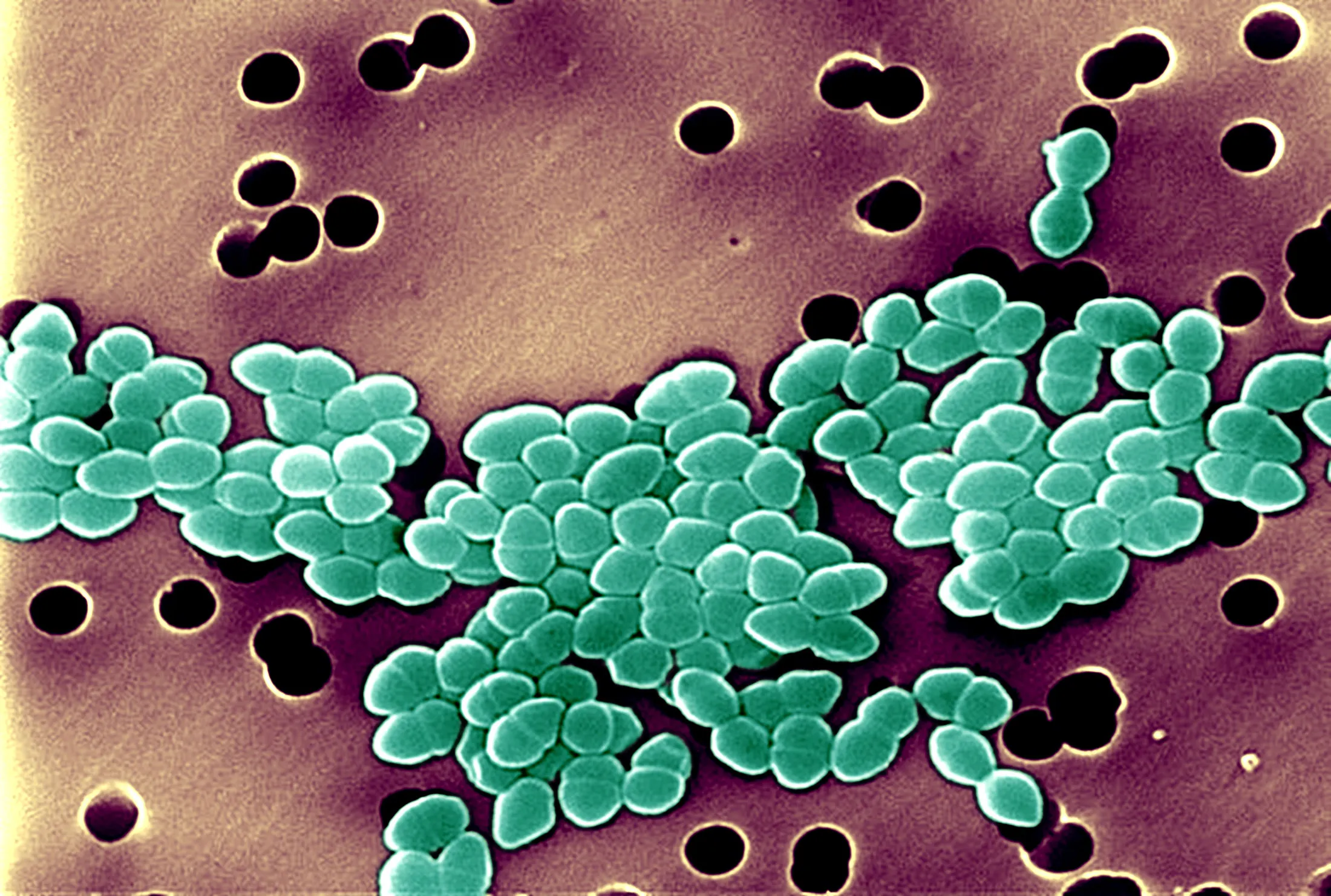 Resistant enterococci&nbsp;bacteria

