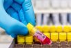 Virology Lab Work As Europe On Coronavirus High Alert