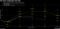 The Fed's September Dot Plot
