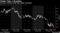 Yields Take a Breather
