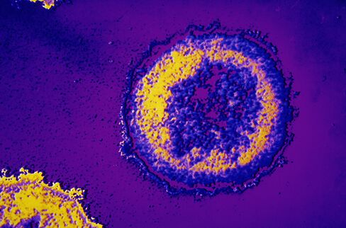 HIV-Infected Infant Cured With Early Use of Virus-Blocking Drugs