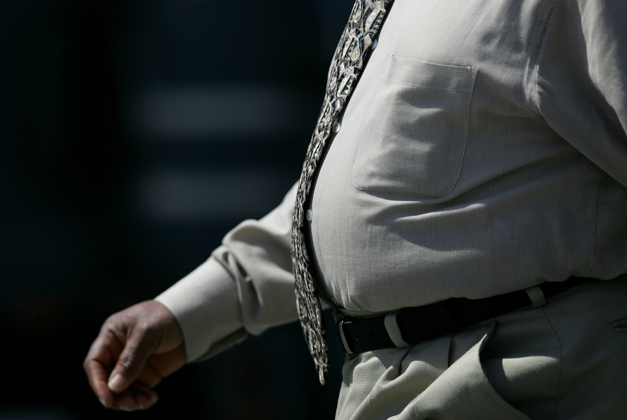Doctors say that getting people who are overweight and have become ill with NASH to change their lifestyles can be an uphill battle.