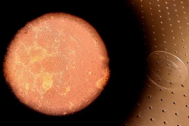 Stem cells through a microscope