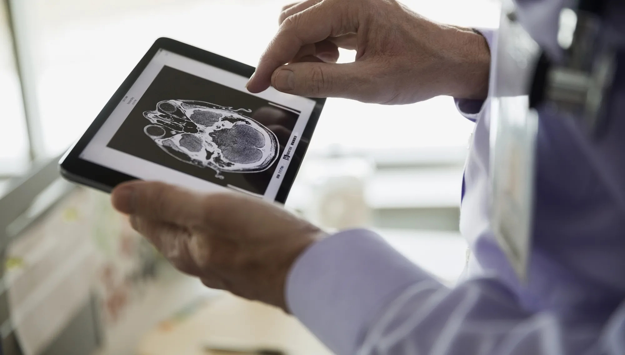 Doctor examining CT scan on digital tablet