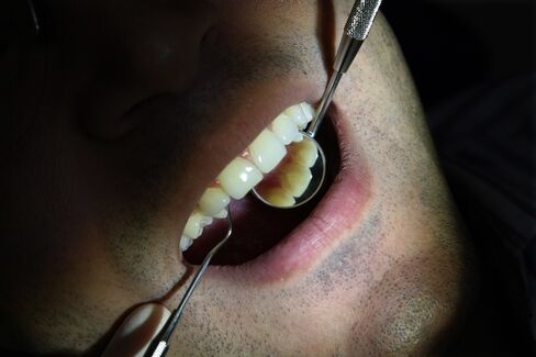 Bacteria in Brains Suggests Oral Hygiene Has Role in Alzheimer’s