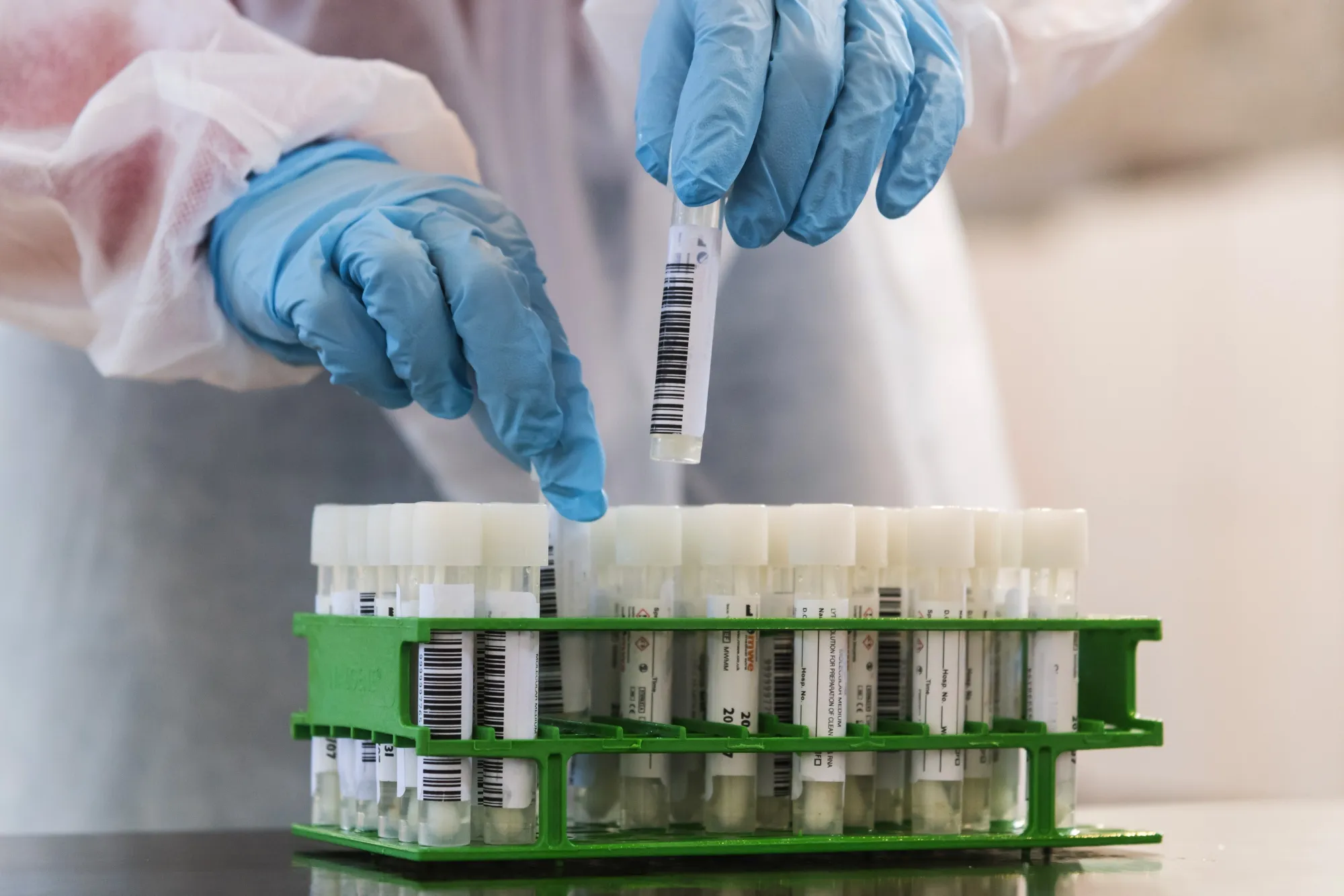 A health worker places Covid-19 swab test tubes into a rack as students undergo testing in the central hall of Leuven University in Lueven, Belgium, on Monday, Oct. 19, 2020. Belgium announced new measures to control the rapid spread of coronavirus, which will see cafes, bars and restaurants closed nationwide for four weeks, and working from home will becoming mandatory where possible.
