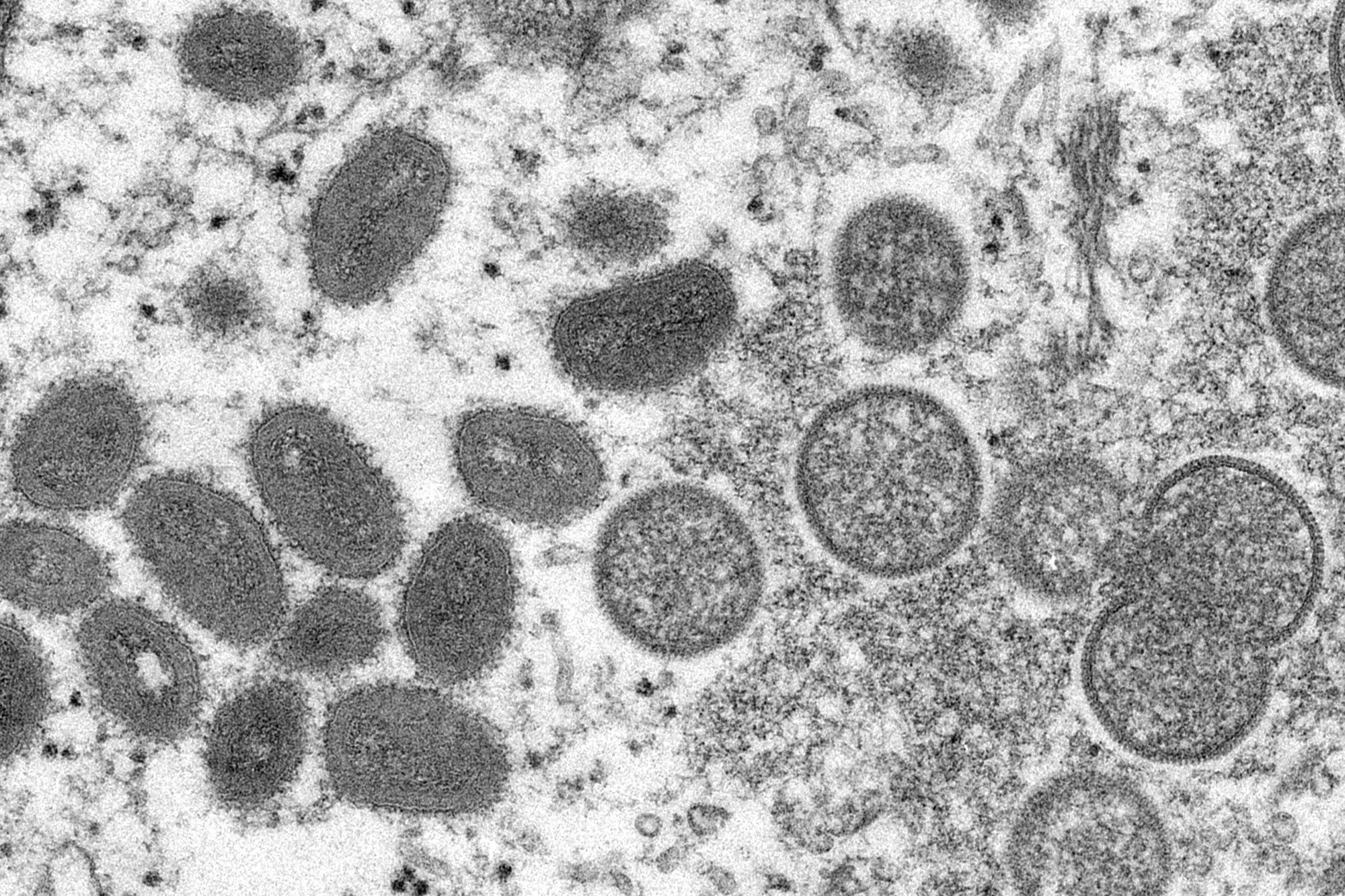 This 2003 electron microscope image made available by the Centers for Disease Control and Prevention shows mature, oval-shaped monkeypox virions, left, and spherical immature virions, right, obtained from a sample of human skin associated with the 2003 prairie dog outbreak.&nbsp;
