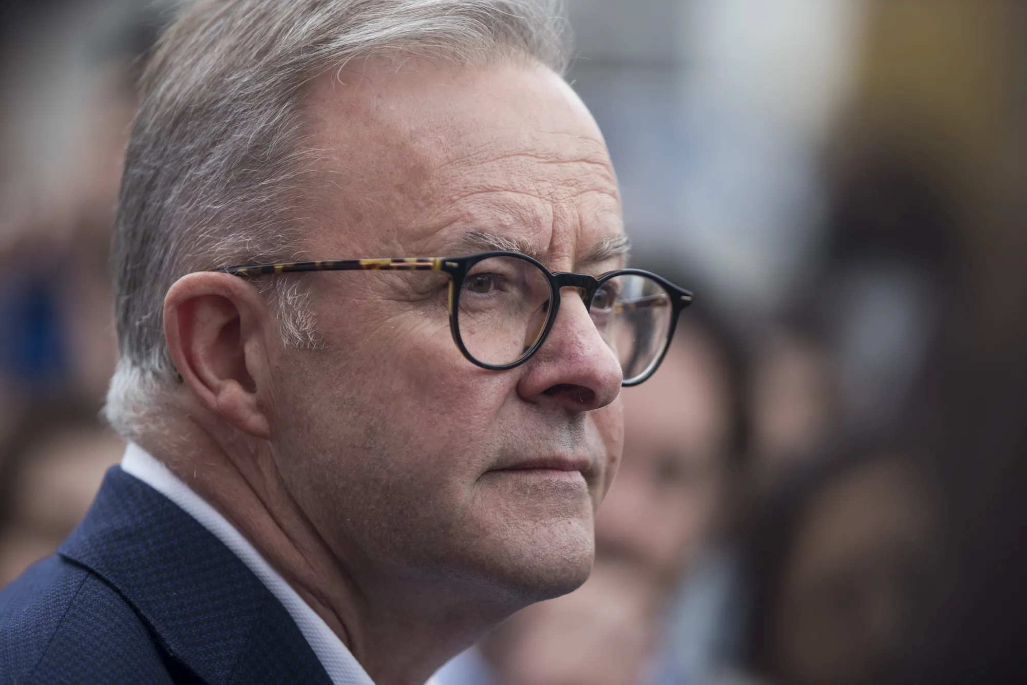 Anthony Albanese