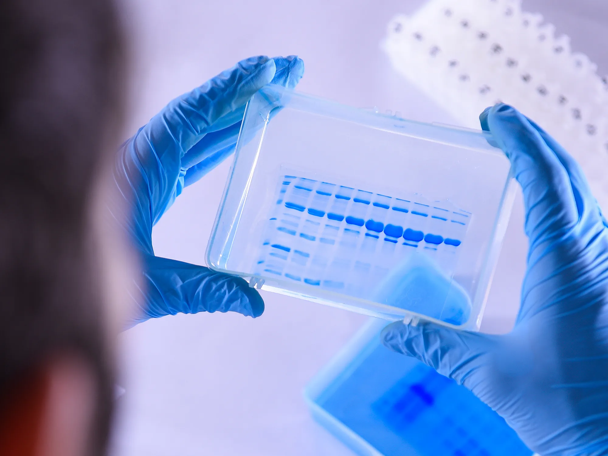 The Technological Vaccine Center of the Federal University of Minas Gerais is Testing a Vaccine against the Coronavirus (COVID - 19) and also Testing Diagnosis Kits