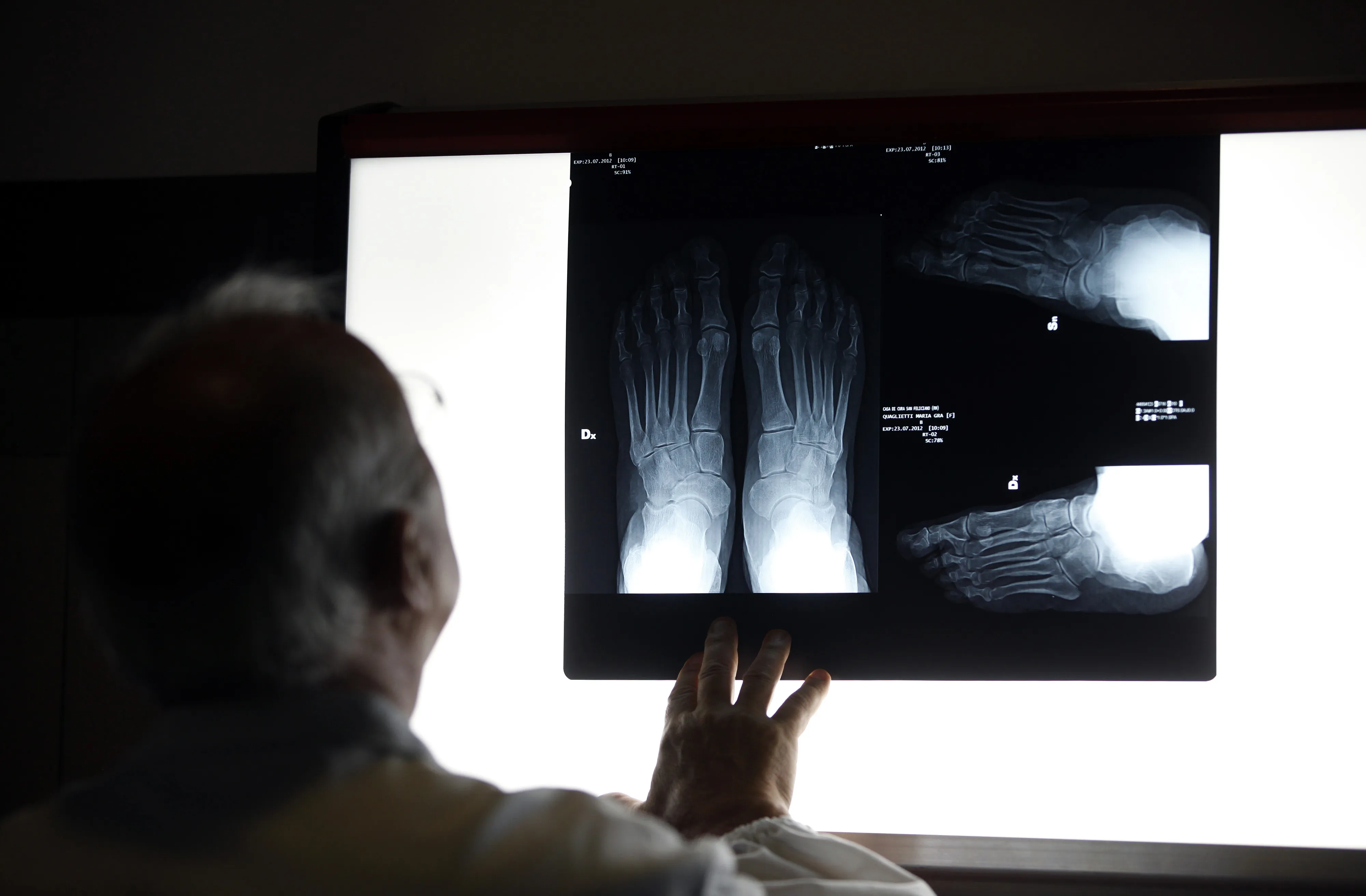 A doctor is seen examining X-ray images in Rome.