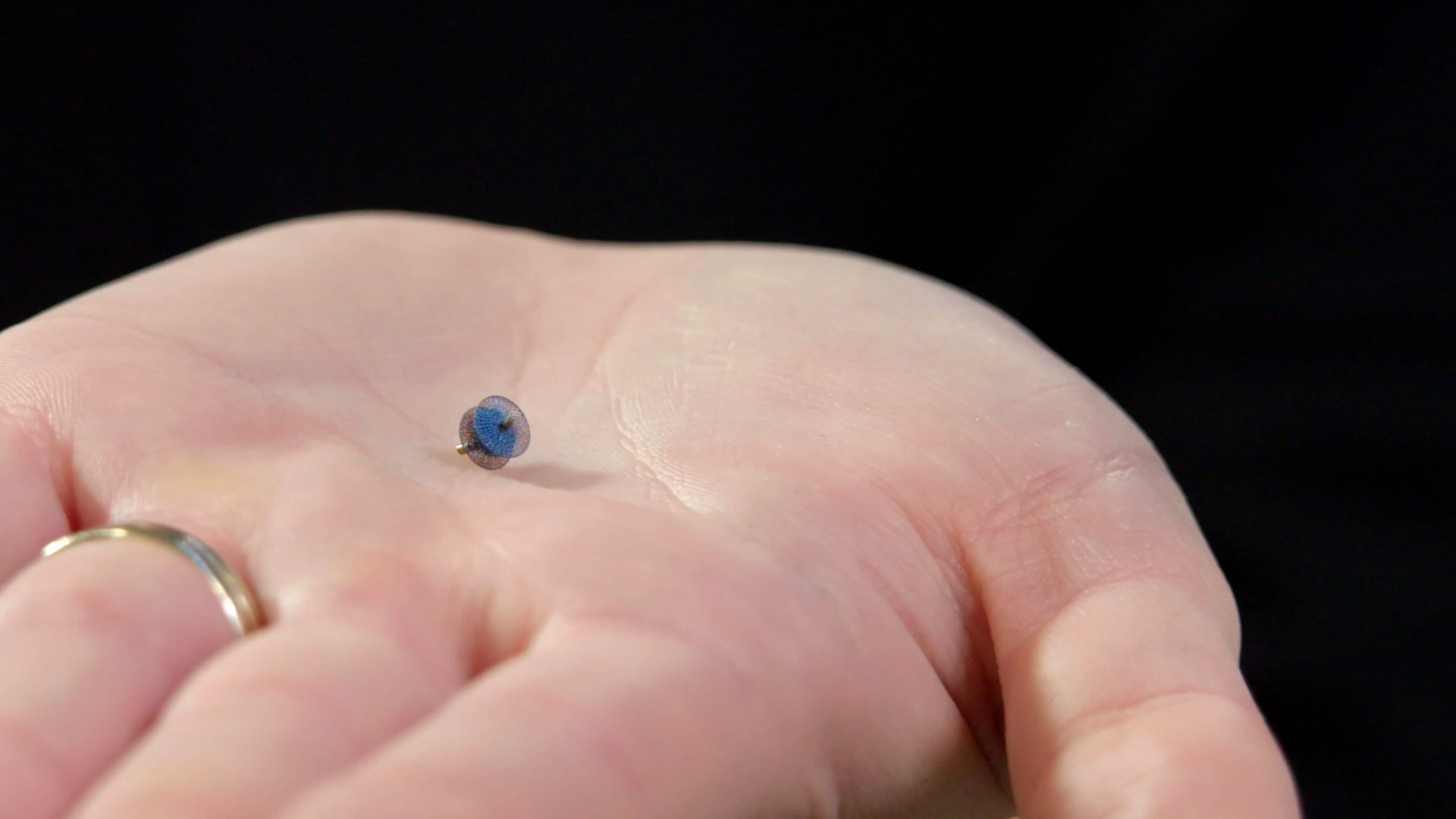 A PeaSized Device Is Approved to Close Holes in Hearts of Tiny Infants
