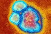 Measles Kills 700 Zimbabwe Children, Sparks Vaccination Drive