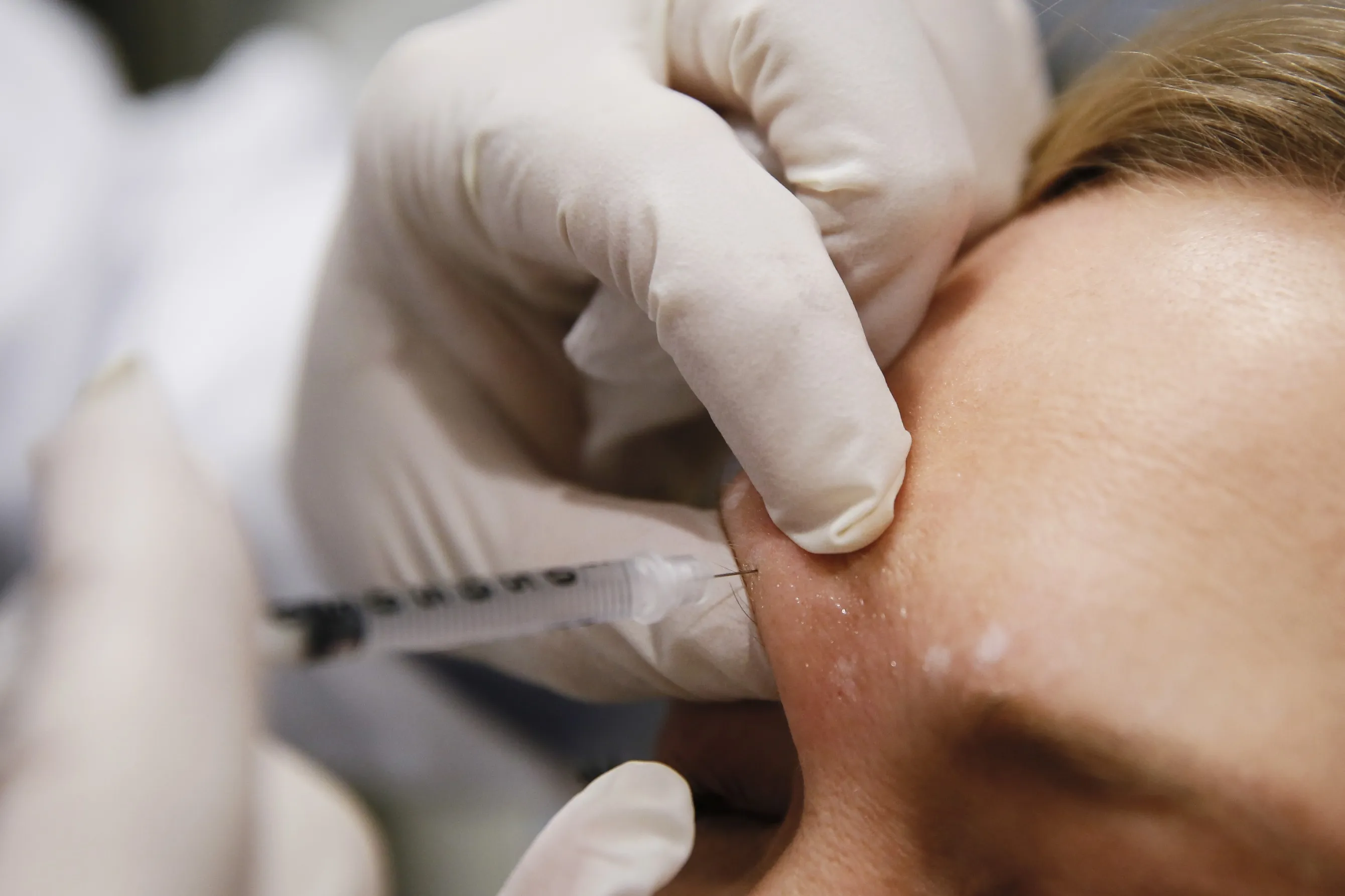 China’s botox market is expanding.
