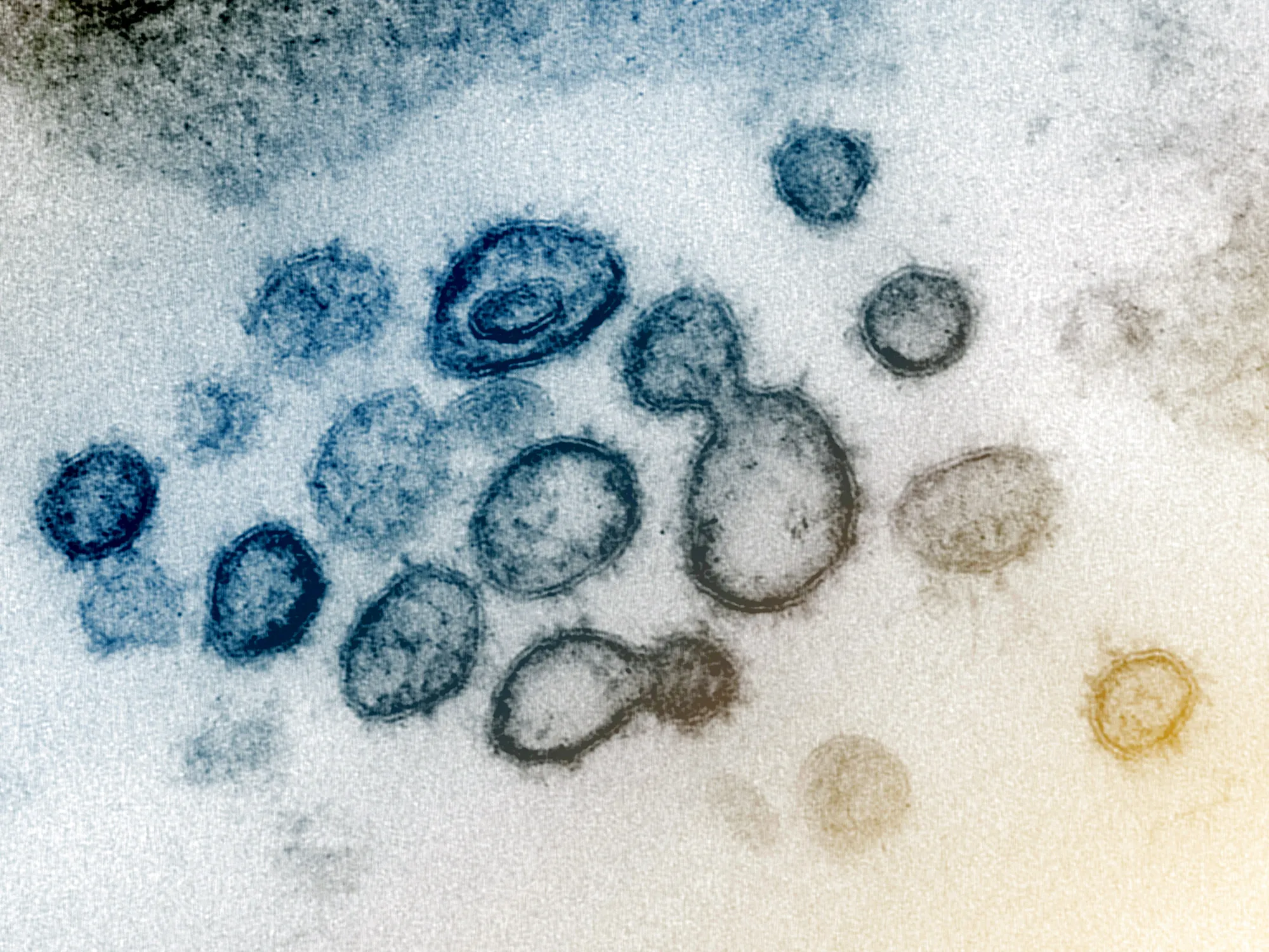 Coronavirus covid-19