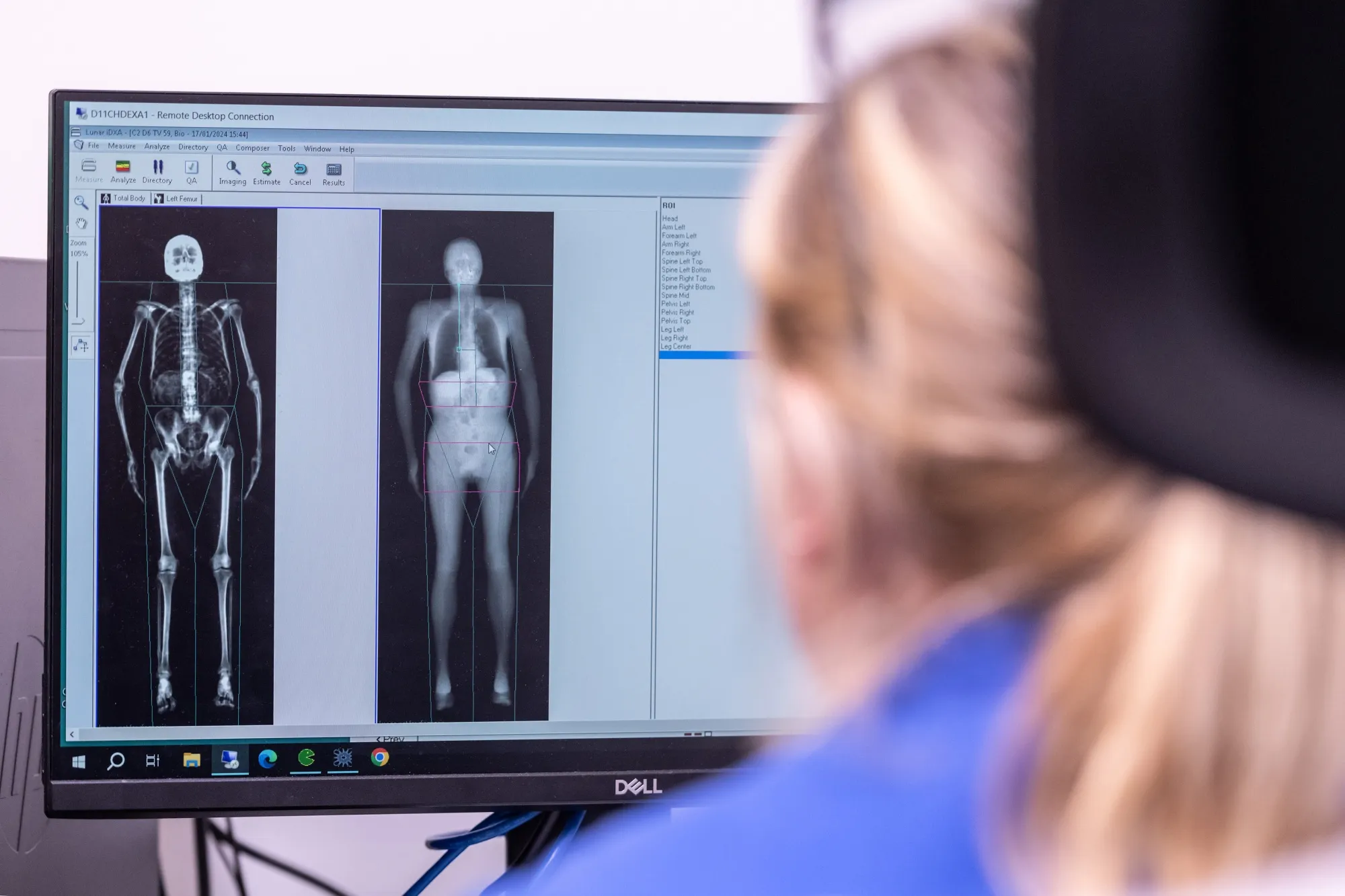 What Scientists Learned Scanning the Bodies of 100,000 Brits - Bloomberg