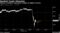 Spooked Crypto Advocates
