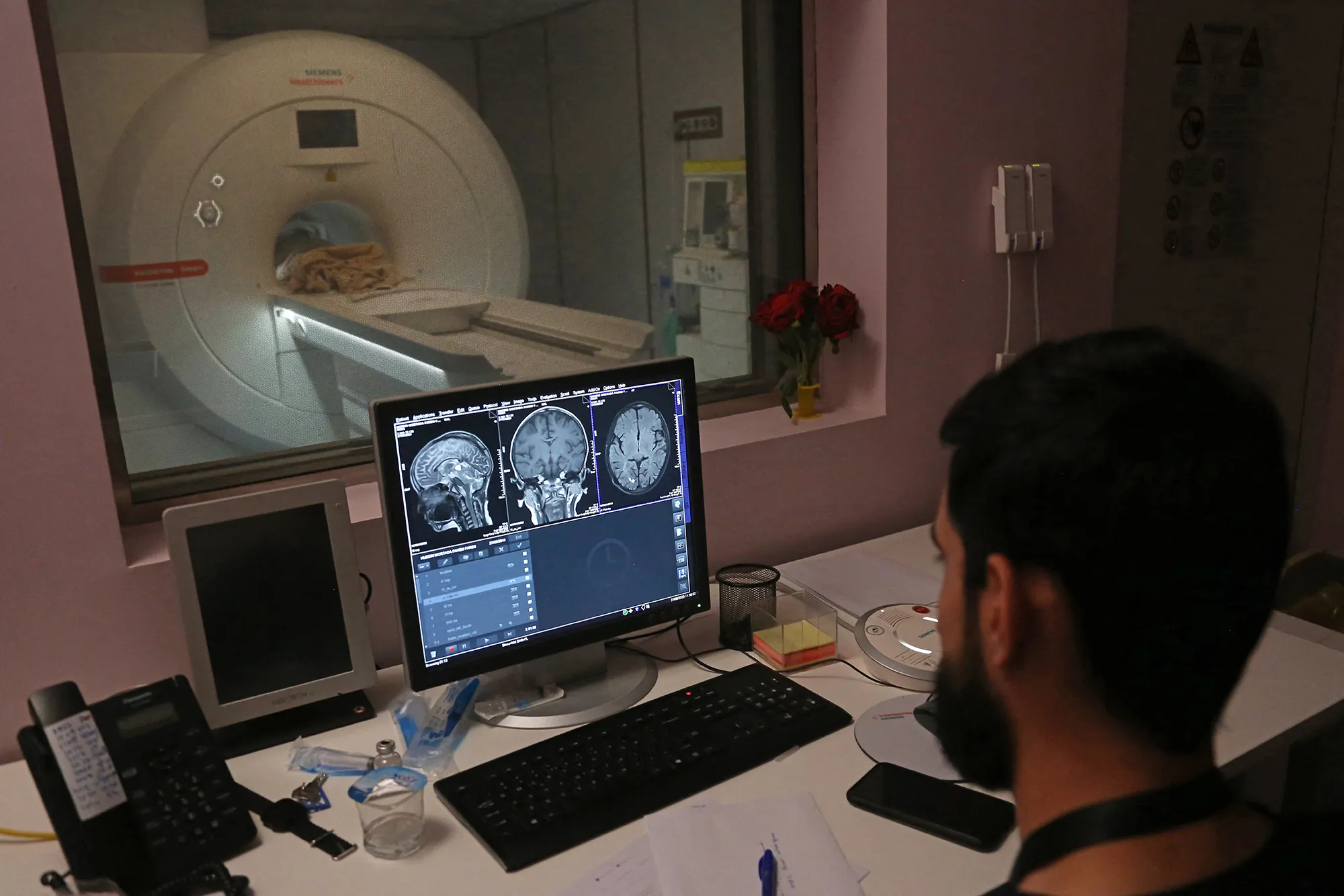 A doctor examines MRI scans.