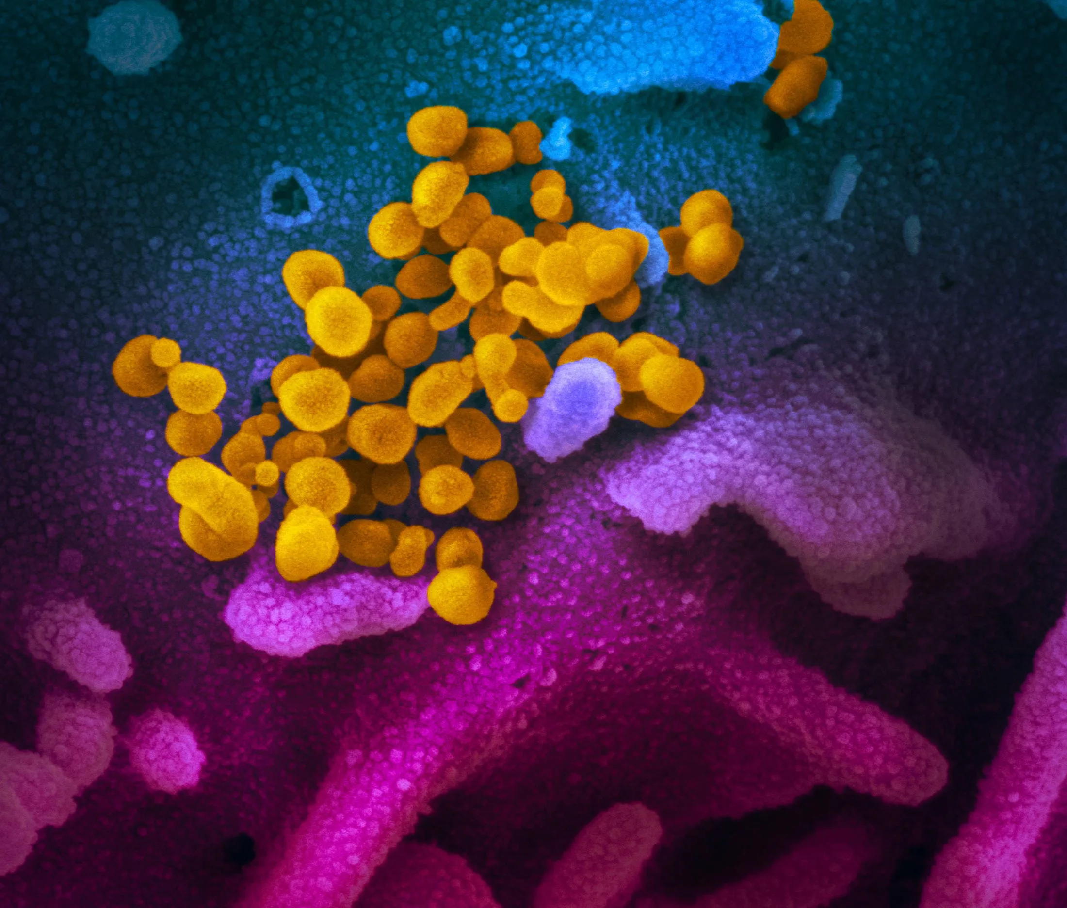 A scanning electron microscope image of the virus, grown from a lab culture.