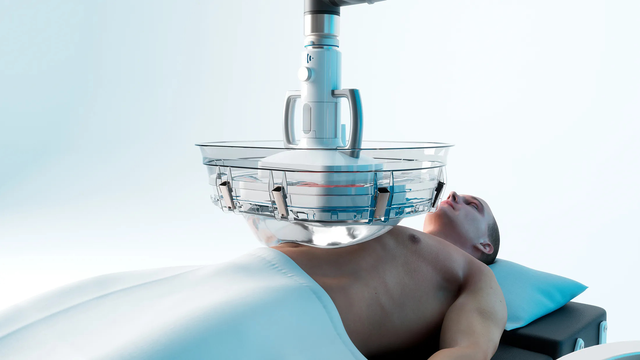 HistoSonics Non-Invasive Edison Histotripsy System