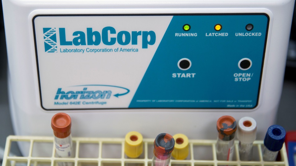 Watch Coronavirus LabCorp Launches Simplified Test for Covid19, Flu