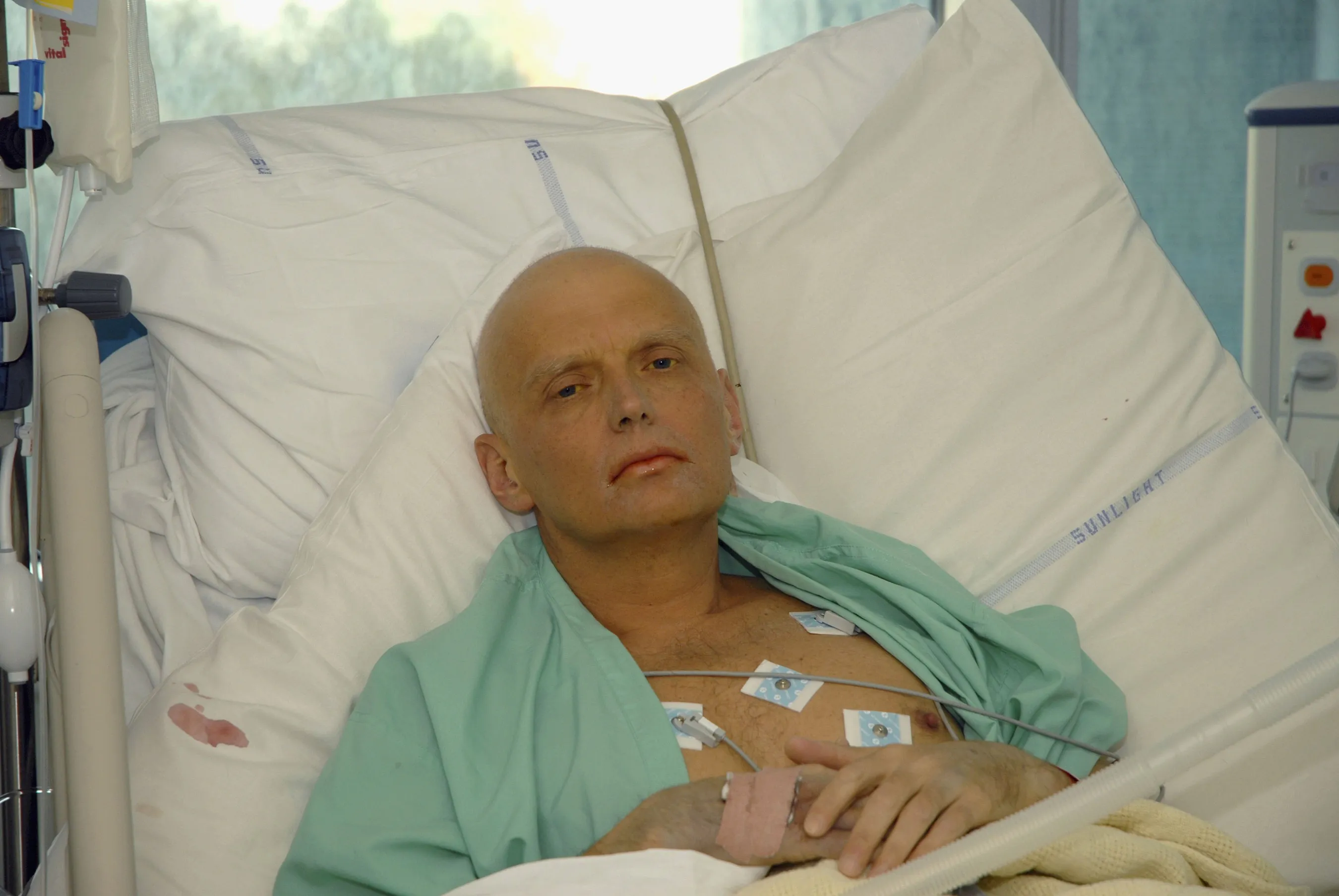 Alexander Litvinenko lies in a hospital bed at the Intensive Care Unit of University College Hospital in London, on Nov. 20, 2006. Litvinenko, a critic of the Kremlin who lived in the U.K. capital, died about three weeks after ingesting radioactive polonium.&nbsp;