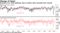 Excessive U.S. stock optimism seen in option-ratio reversals from records