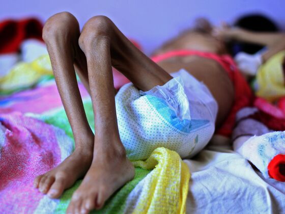 Bombings and Starvation: Focus Turns to Saudi’s War in Yemen