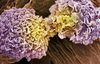 Breast cancer cells