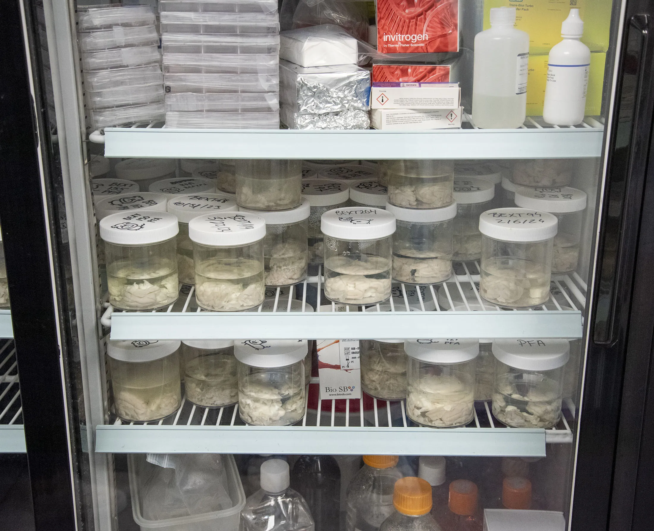 Crypto Millionaire Fuels Push to Transform Brain Research - Bloomberg